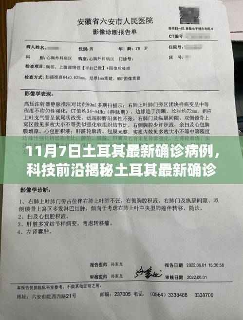 科技利器揭秘土耳其最新确诊病例,智能医疗重塑抗疫新篇章