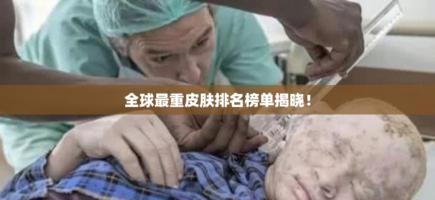 全球最重皮肤排名榜单揭晓!